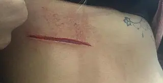Após discussão com vizinha, mãe e filha são esfaqueadas em Itaquá