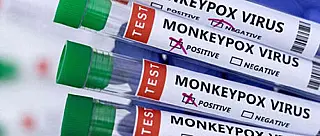 OMS declara fim da emergência de saúde da Varíola dos Macacos