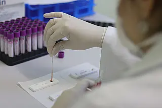 Secretaria de Saúde segue com campanha para detecção do vírus HIV e sífilis