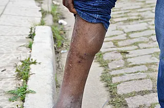Animal abandonado ataca com mordidas no Jd. Fernandes