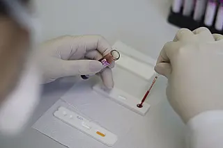 Suzano inicia campanha de testagem rápida de ISTs