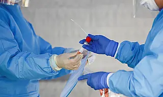 MS confirma primeiro caso de reinfecção por Covid-19 no país
