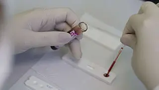 Serviço de Testagem e Acolhimento muda de endereço em Suzano