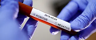 Casos de Covid-19 disparam no início do ano e preocupam cidades