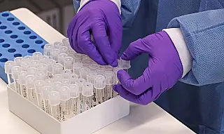 SP registra 25,1 mil óbitos e 628,4 mil casos de coronavírus