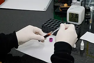 Saúde intensifica testagens de sífilis e conscientização em referência à campanha ‘Outubro Verde’